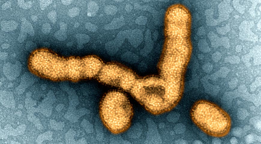H1N1 Influenza Virus Particles –coloreado por ordenador– (CC) NIAID @ Flickr